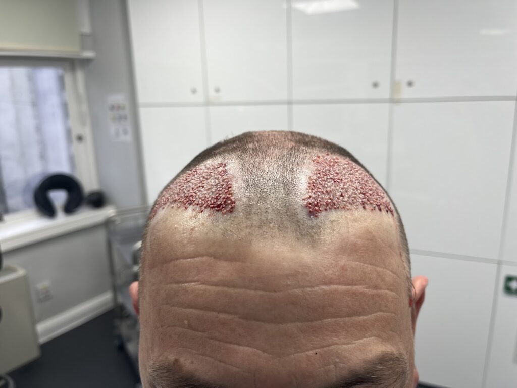 Hair Growth Centre gallery photo