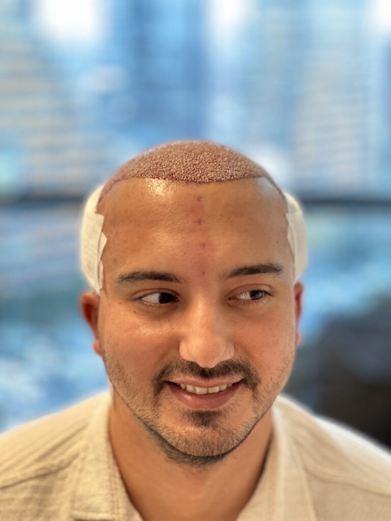 The Best Hair Transplant – FUE Maximum Graft in 1 Day Dubai Clinic / SBL Health — clinic photo from Google Maps