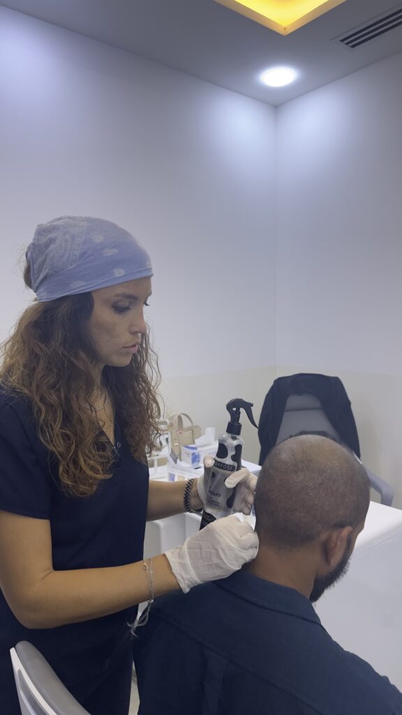 The Best Hair Transplant – FUE Maximum Graft in 1 Day Dubai Clinic / SBL Health gallery photo