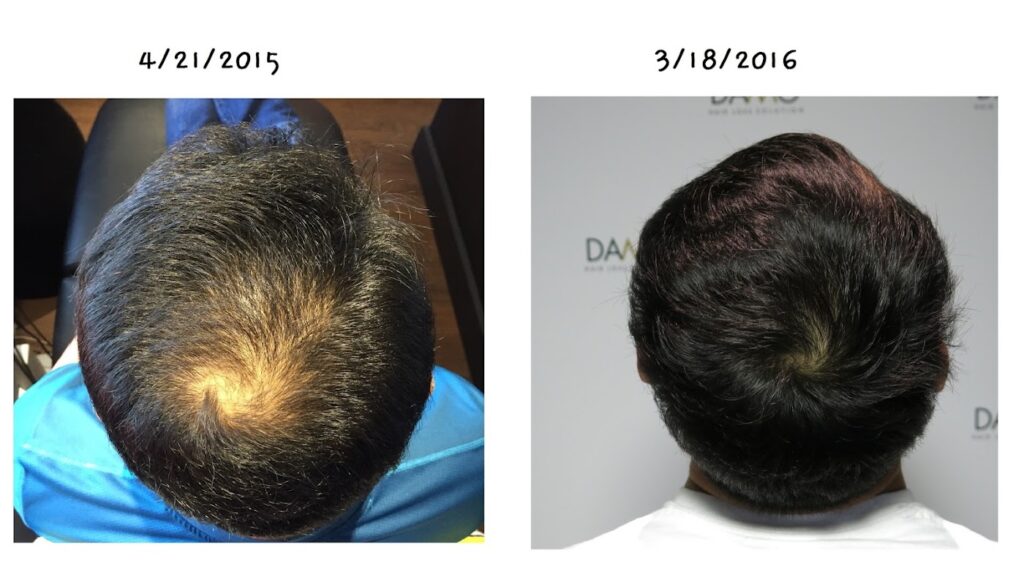 Hair Loss Clinic DAMO gallery photo