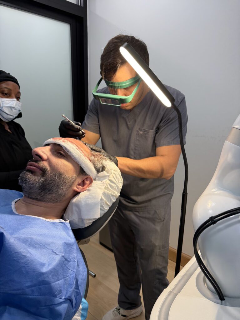 New York Hair Transplant gallery photo