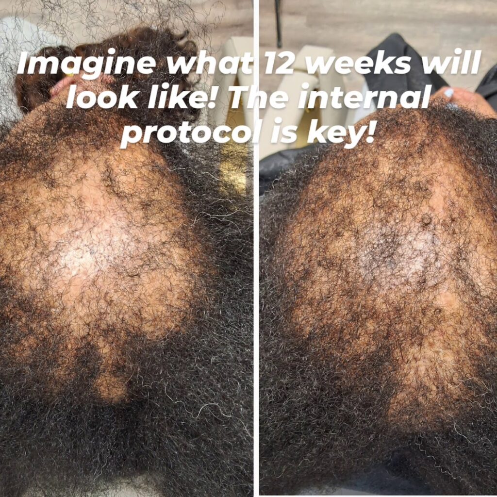 Beyond Your Hair Trichology Spa gallery photo