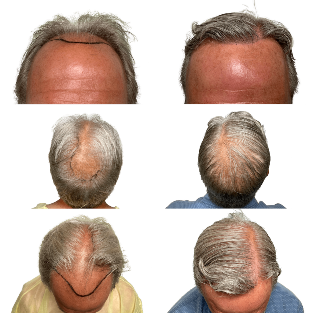 Maxim Hair Restoration & Transplants – Philadelphia gallery photo