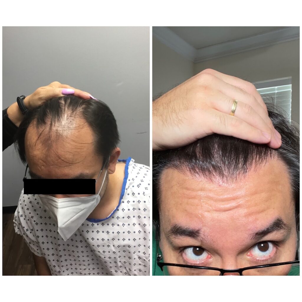Honest Hair Restoration gallery photo