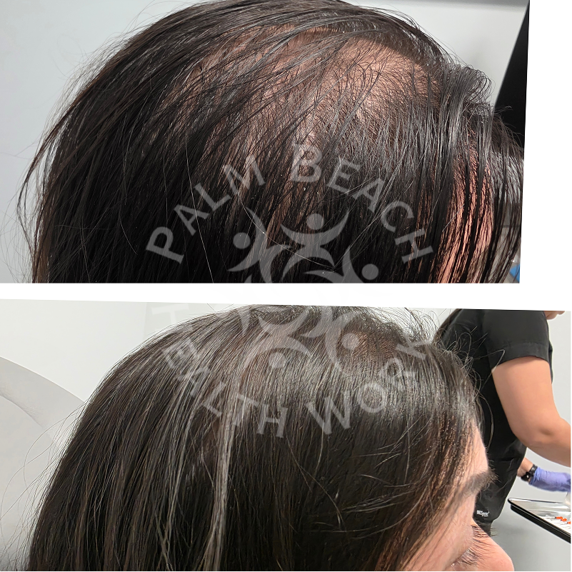 Palm Beach HealthWorks – Hair Replacement | Joint Pain Therapy | Wellness & Weight Loss | TRT Therapy gallery photo