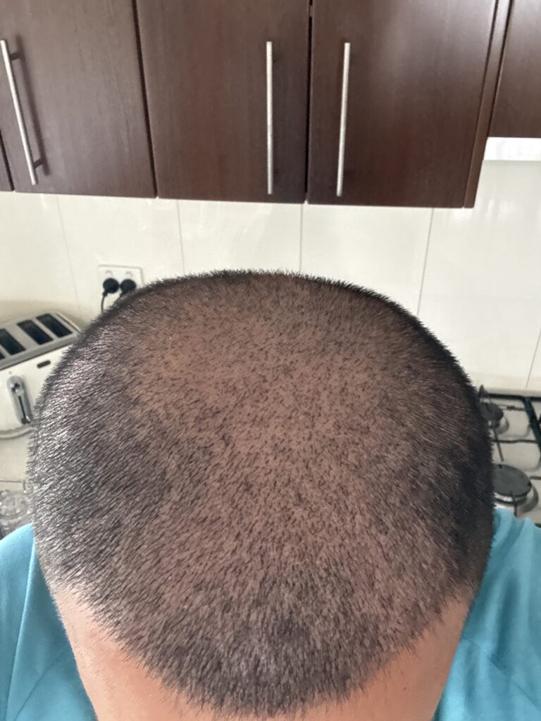 Hair Restoration Doctors gallery photo