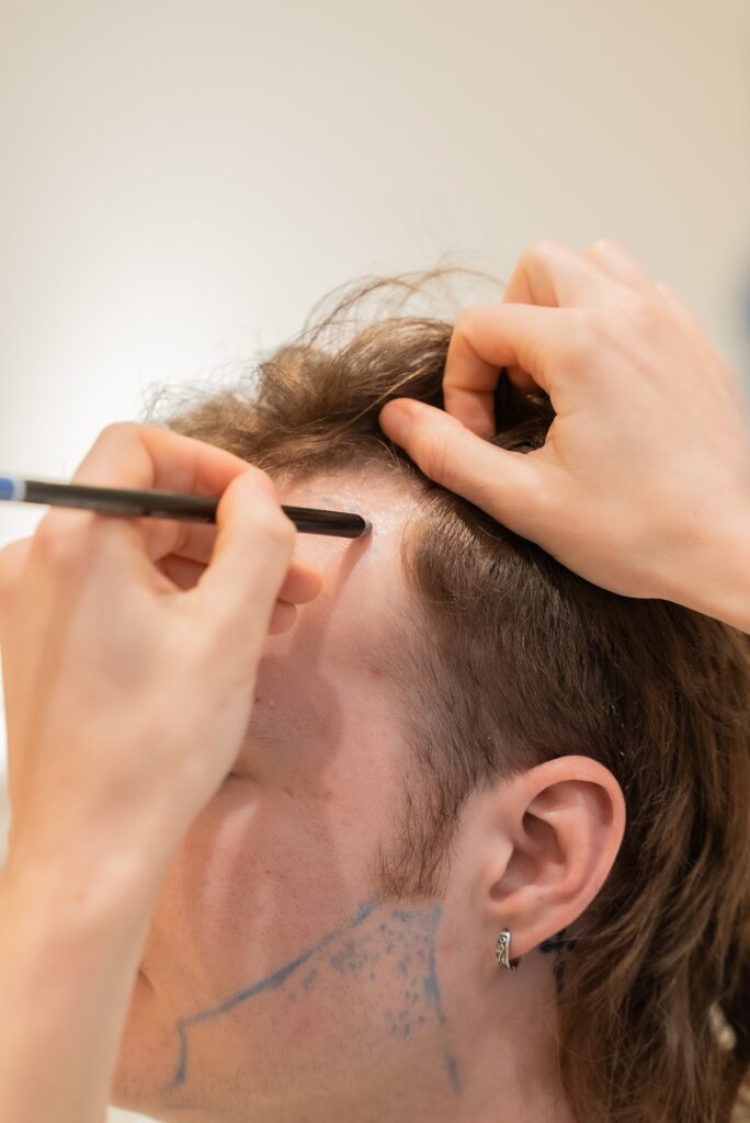 Hairmás Hair Clinic gallery photo