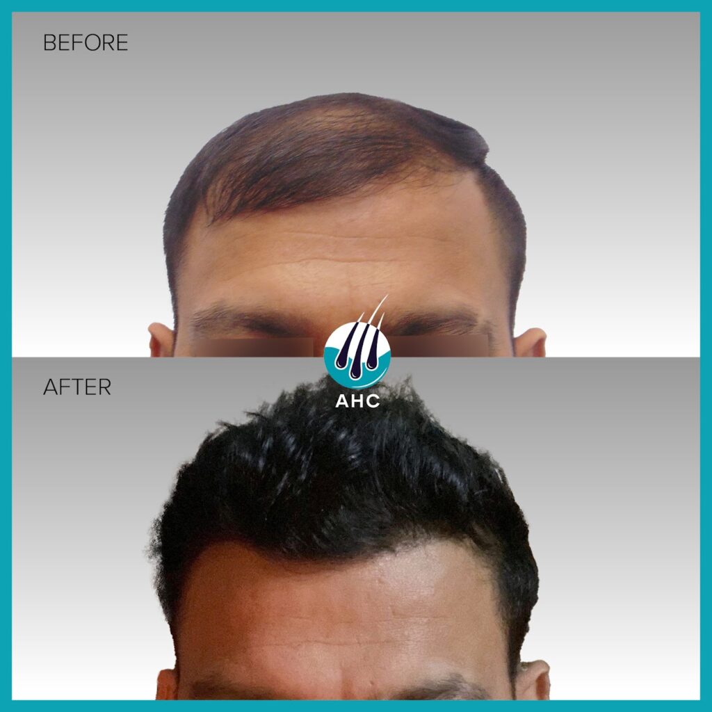 Advanced Hair Clinics gallery photo
