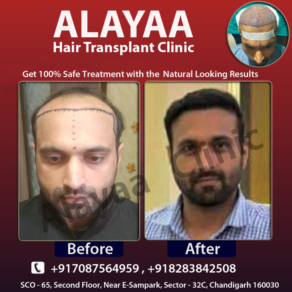 Alayaa Hair Transplant Specialist — clinic photo from Google Maps