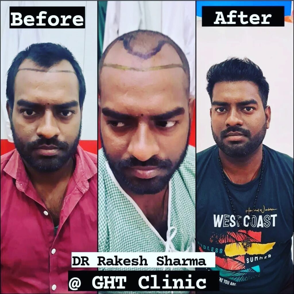 Gurgaon Hair Transplant Centre gallery photo