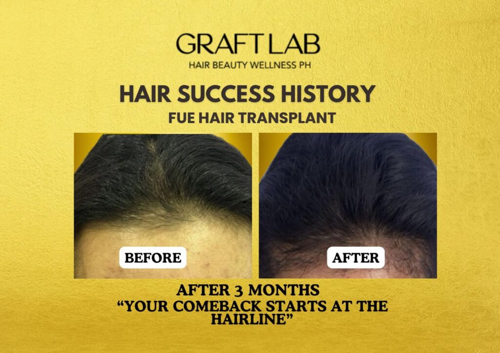 GraftLab Hair, Beauty & Wellness gallery photo