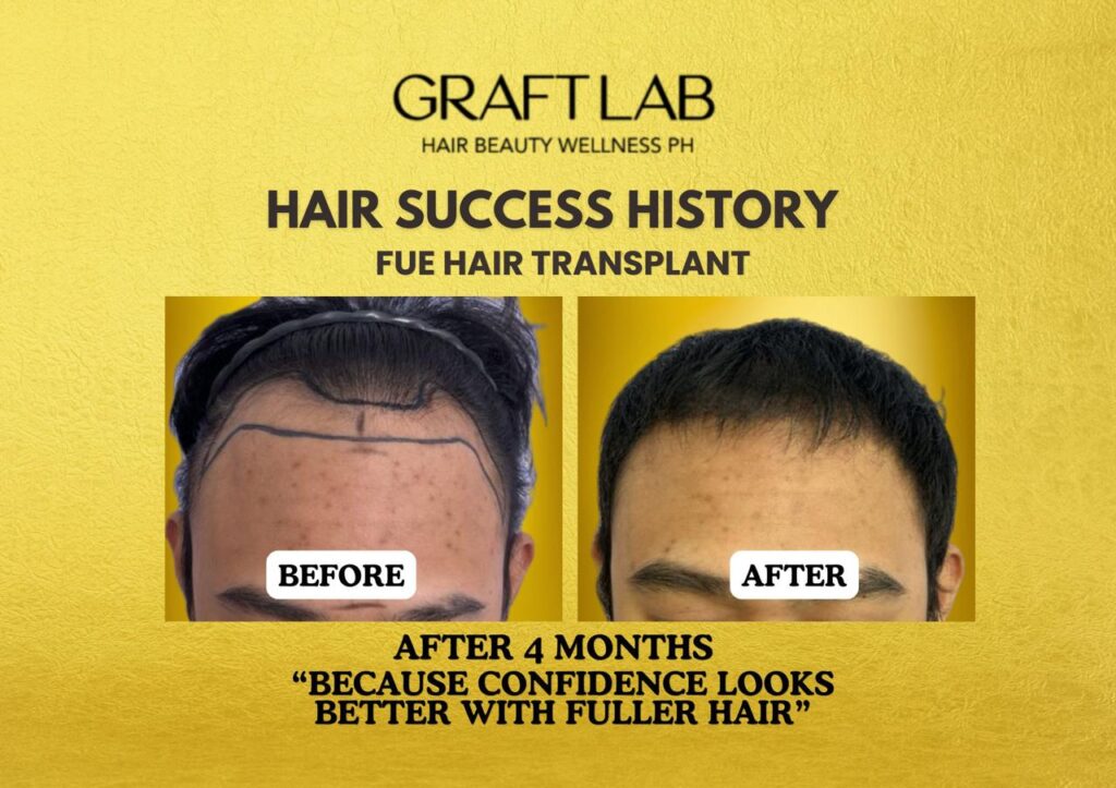 GraftLab Hair, Beauty & Wellness gallery photo