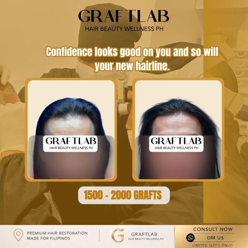 GraftLab Hair, Beauty & Wellness gallery photo