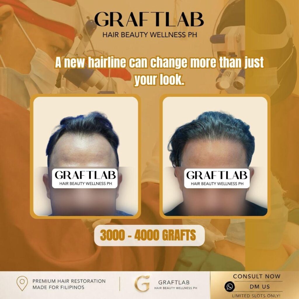 GraftLab Hair, Beauty & Wellness gallery photo