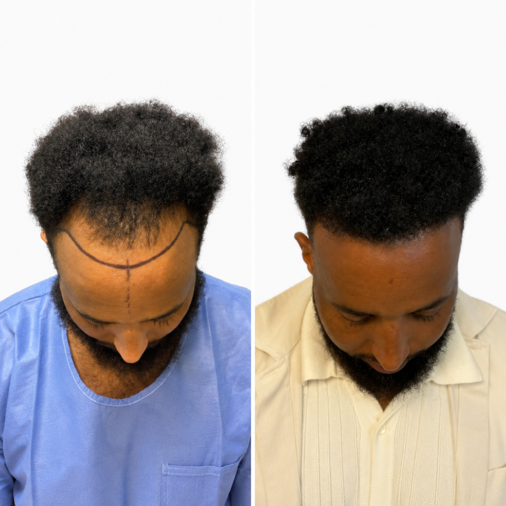 Bonita Hair Clinic Capetown gallery photo