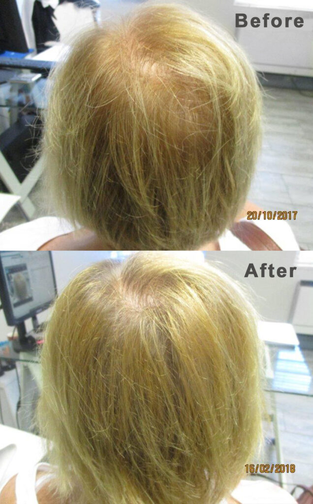 Hair Clinic International Umhlanga gallery photo