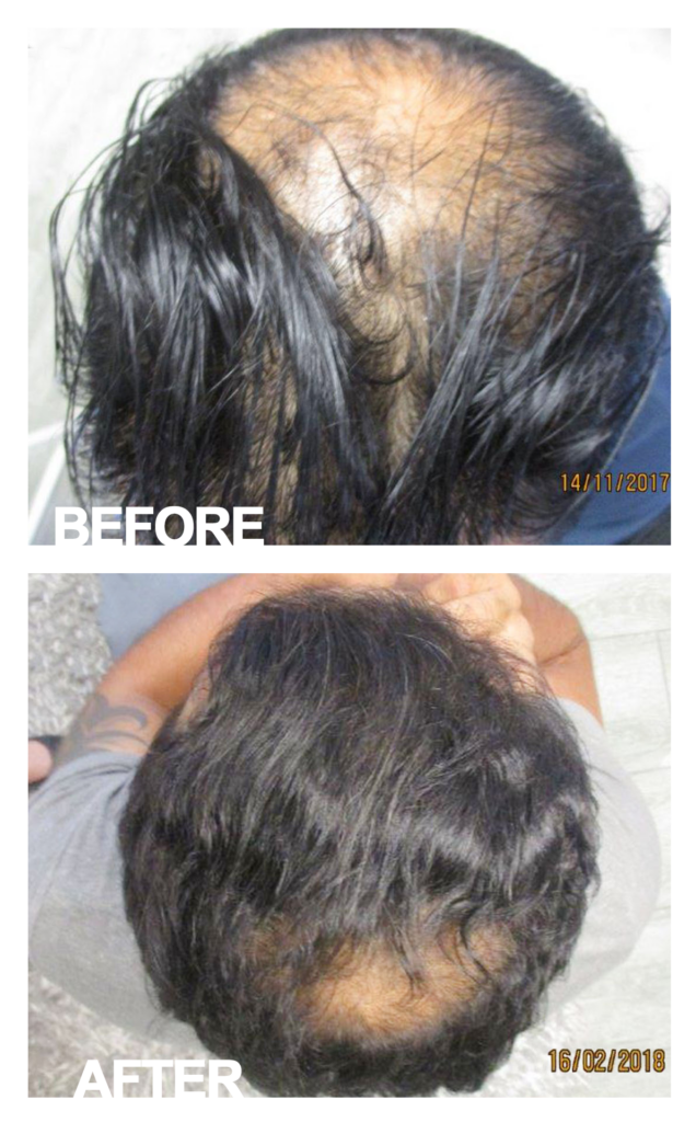 Hair Clinic International Umhlanga gallery photo