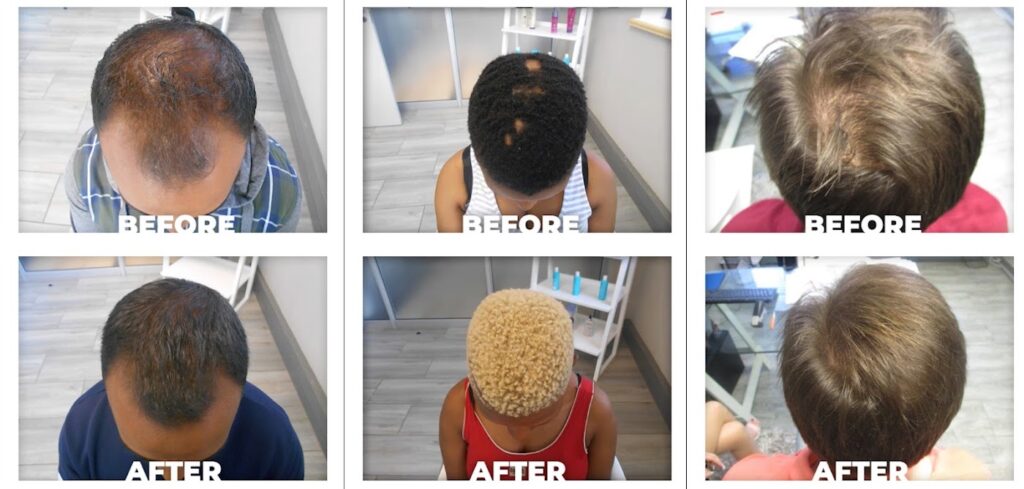 Hair Clinic International Umhlanga gallery photo