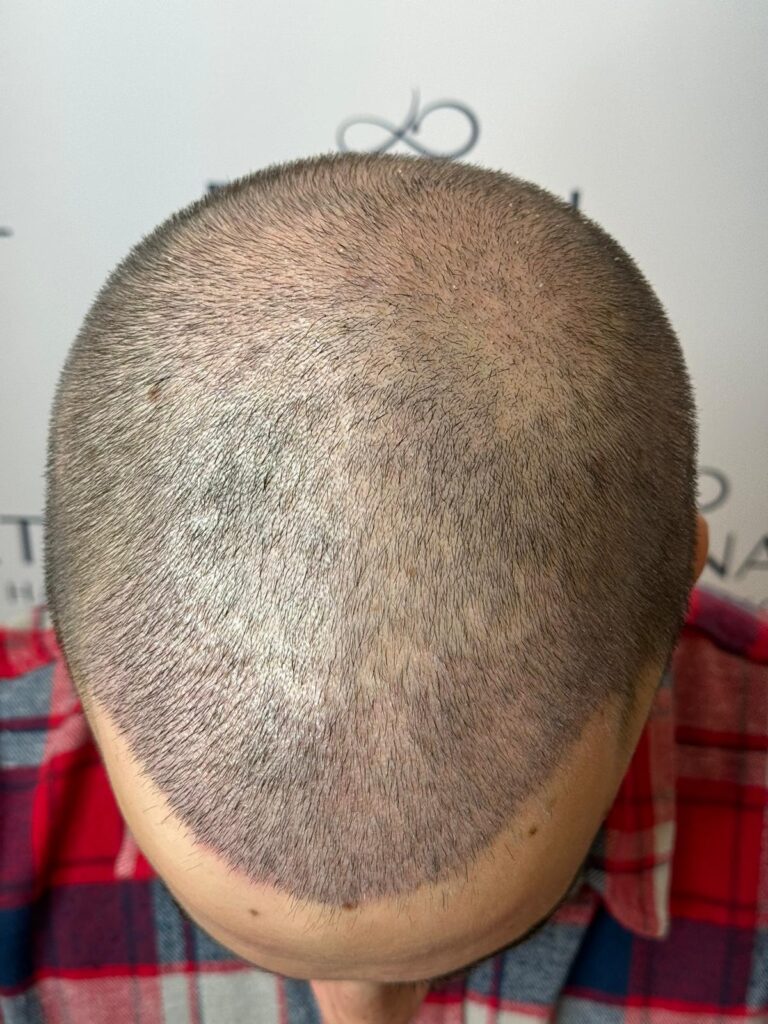 Eternal Hair Clinic — clinic photo from Google Maps