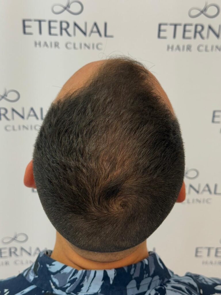 Eternal Hair Clinic gallery photo