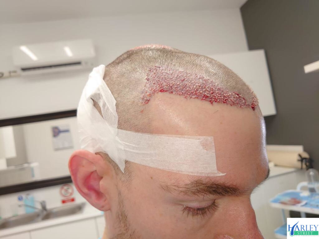 Manchester Hair Transplants Clinics gallery photo