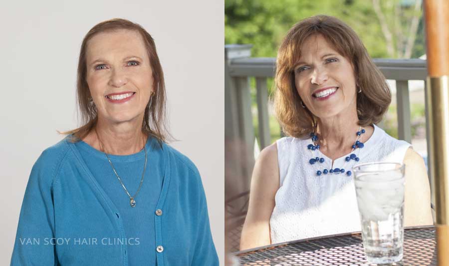 Van Scoy Hair Clinic – Columbus gallery photo