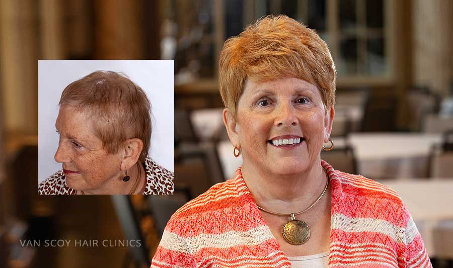 Van Scoy Hair Clinic – Columbus gallery photo