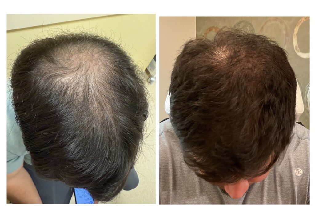 Rejuv Hair Clinic | Hair Restoration gallery photo