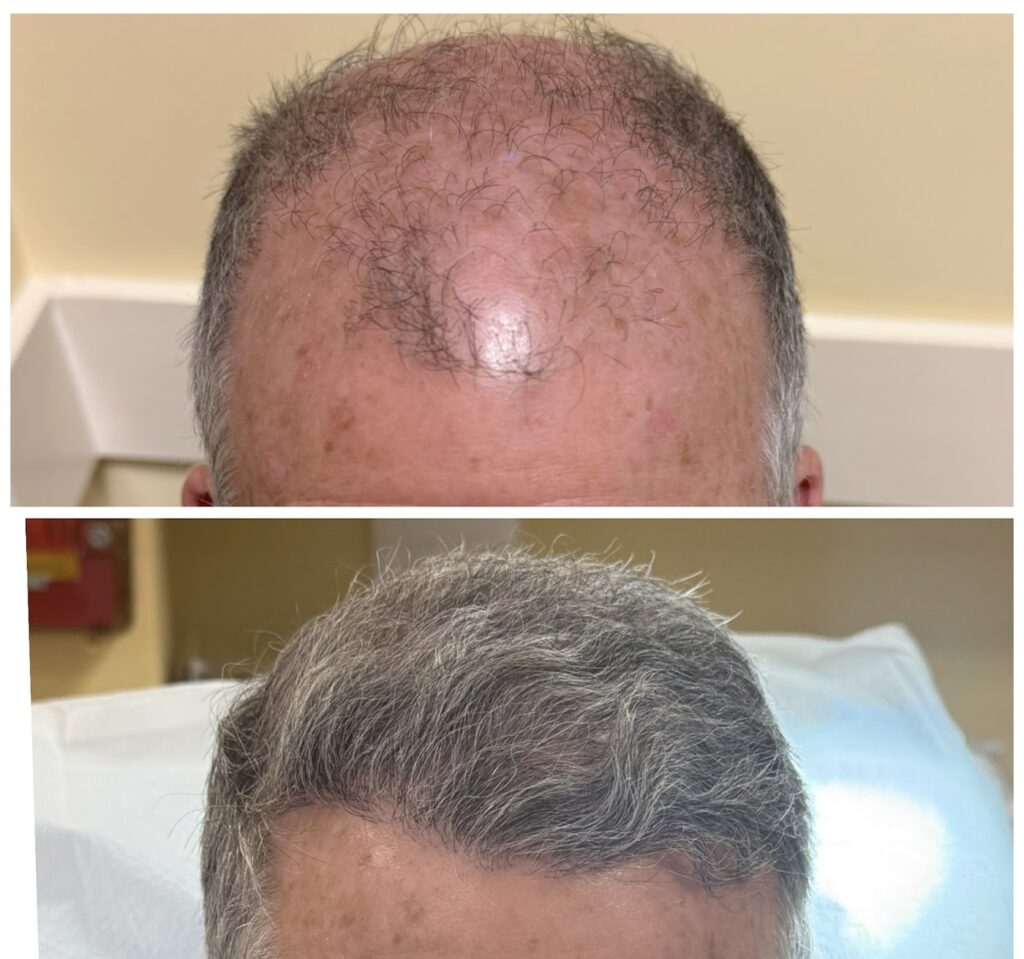 Rejuv Hair Clinic | Hair Restoration gallery photo