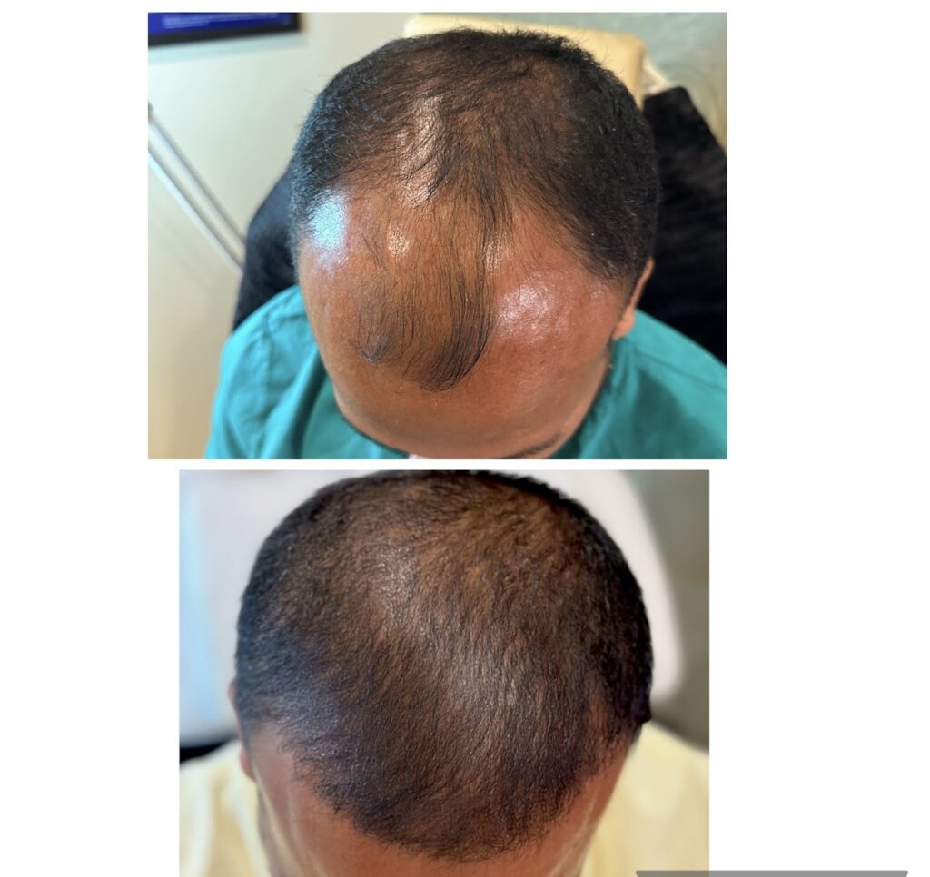 Rejuv Hair Clinic | Hair Restoration gallery photo