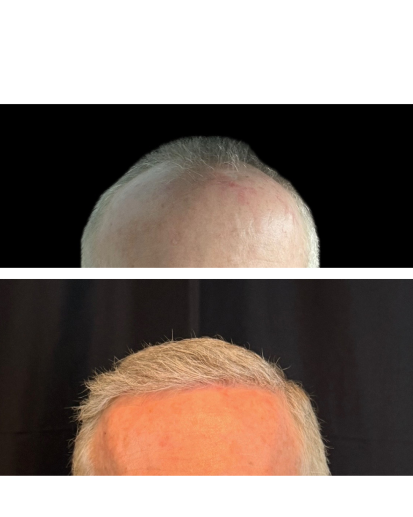Rejuv Hair Clinic | Hair Restoration gallery photo