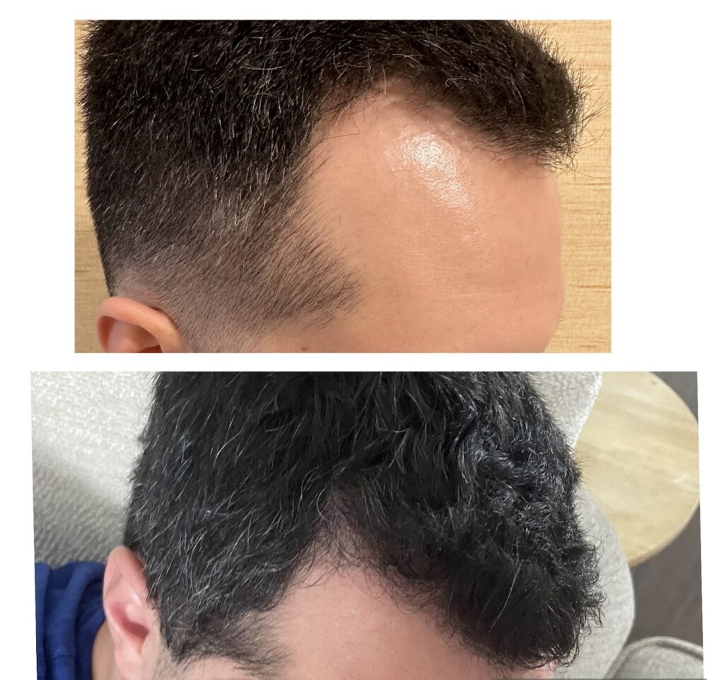 Rejuv Hair Clinic | Hair Restoration gallery photo
