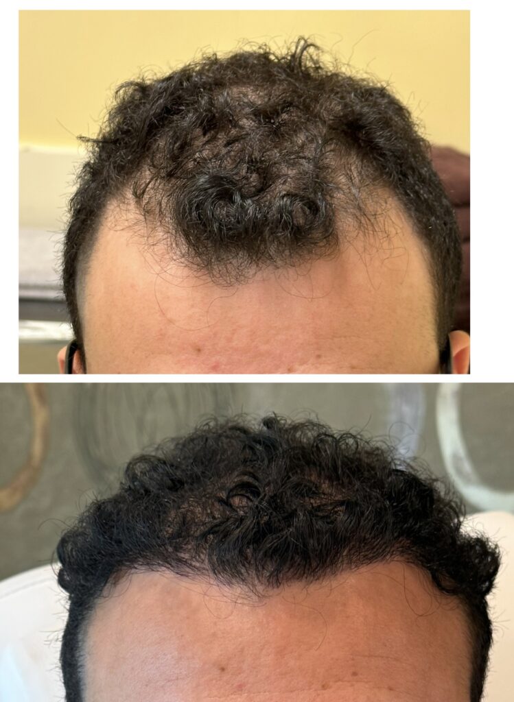 Rejuv Hair Clinic | Hair Restoration gallery photo