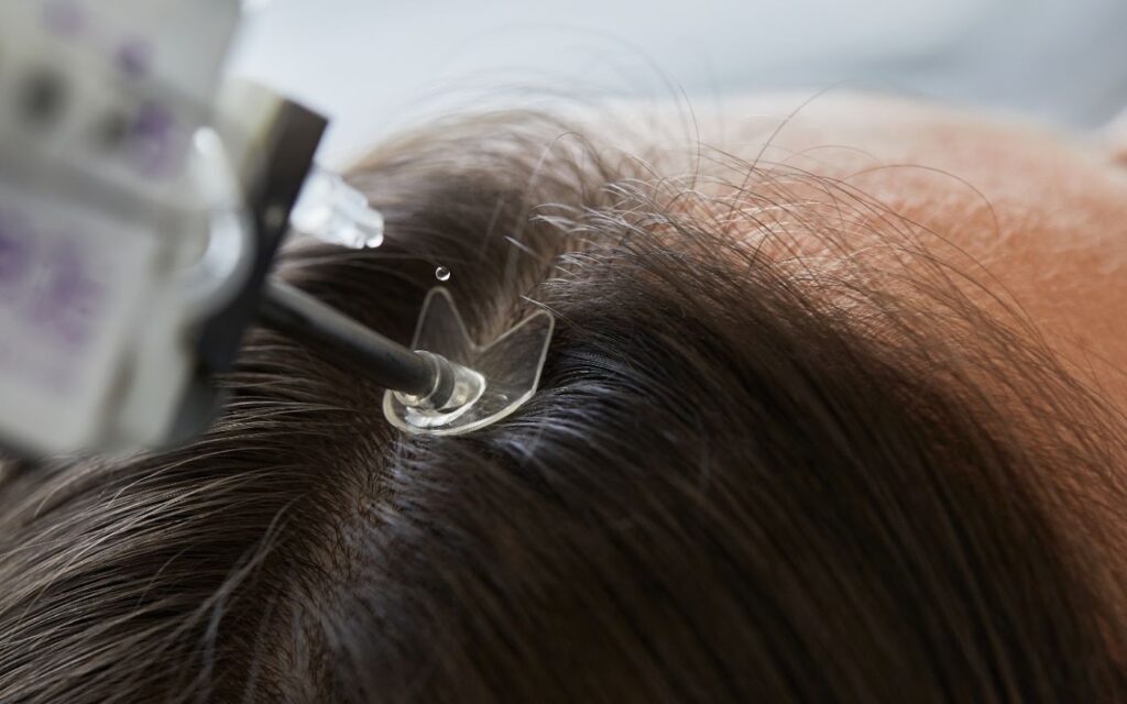 Medi Dental Hair Clinic gallery photo