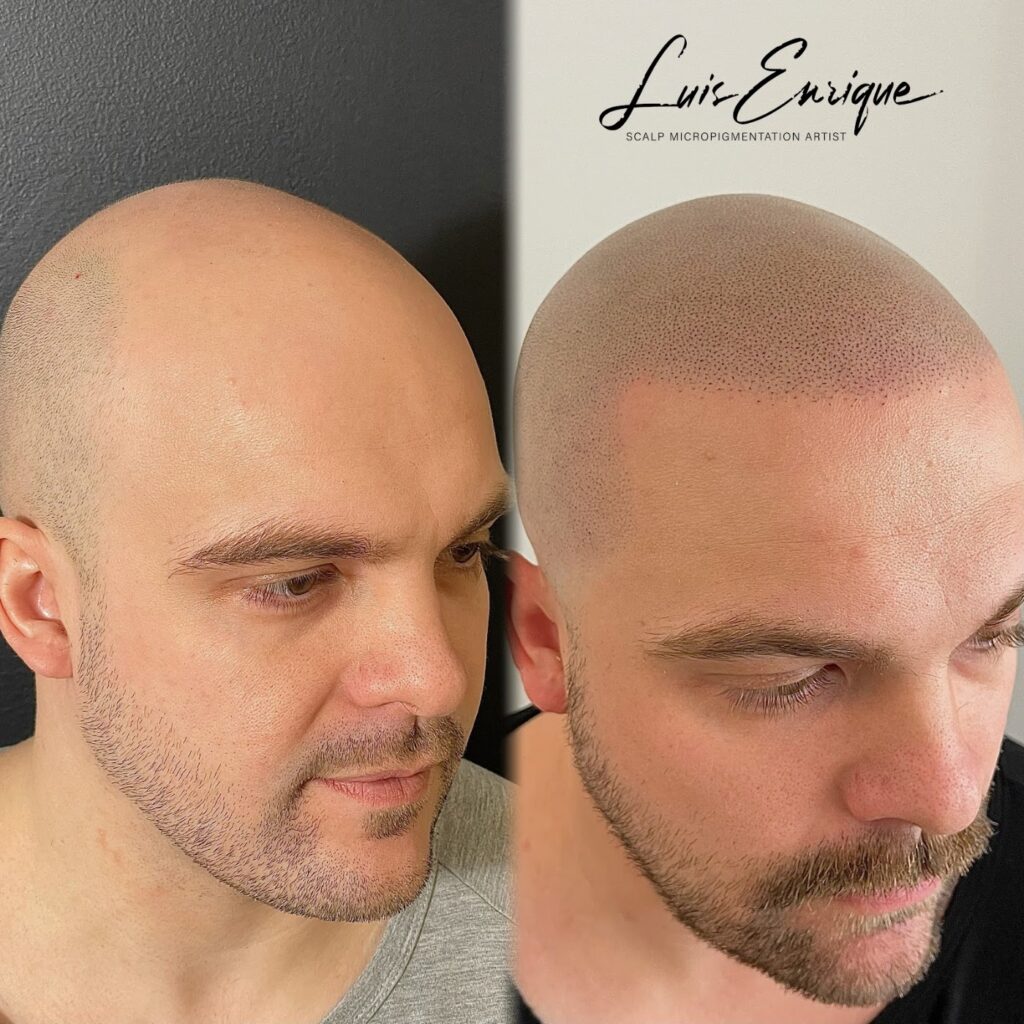 SMP Vancouver – Hair Tattoo Inc. | SMP By Luis Enrique — clinic photo from Google Maps