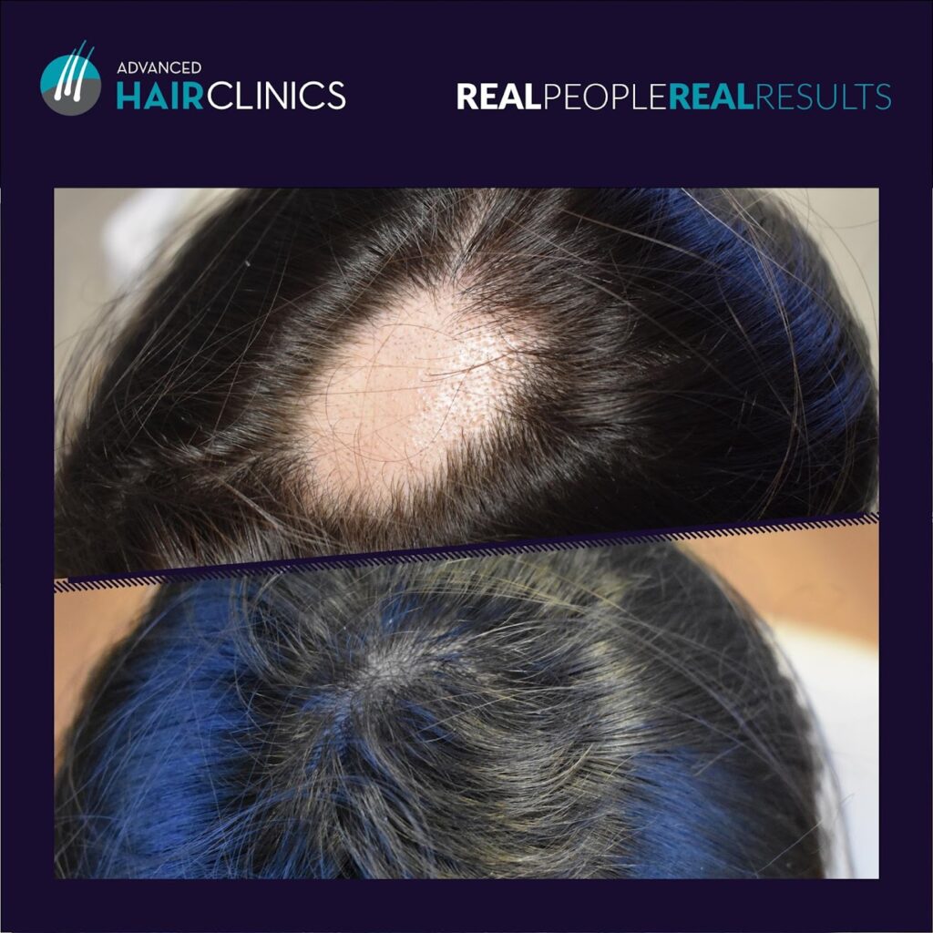 Advanced Hair Clinics gallery photo