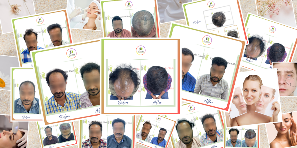 Kalon Hair Transplant & Cosmetic Clinics — clinic photo from Google Maps