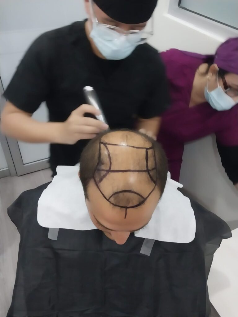 HairMex Hair Transplant Clinic — clinic photo from Google Maps