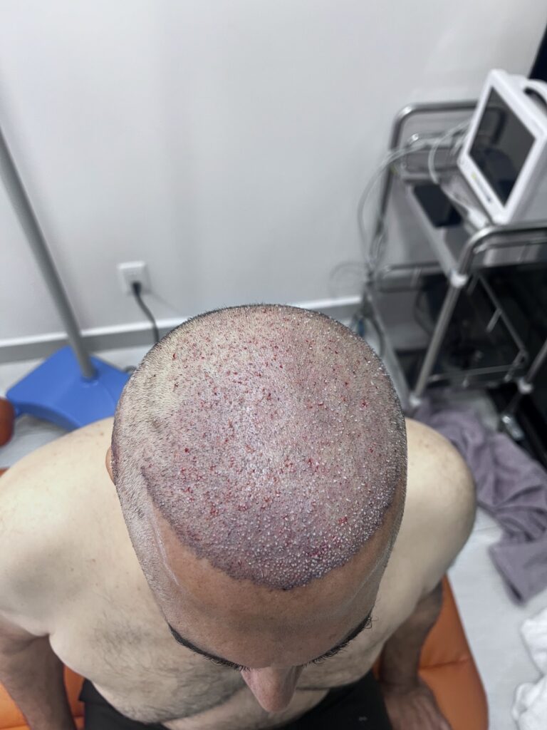 HairMex Hair Transplant Clinic gallery photo