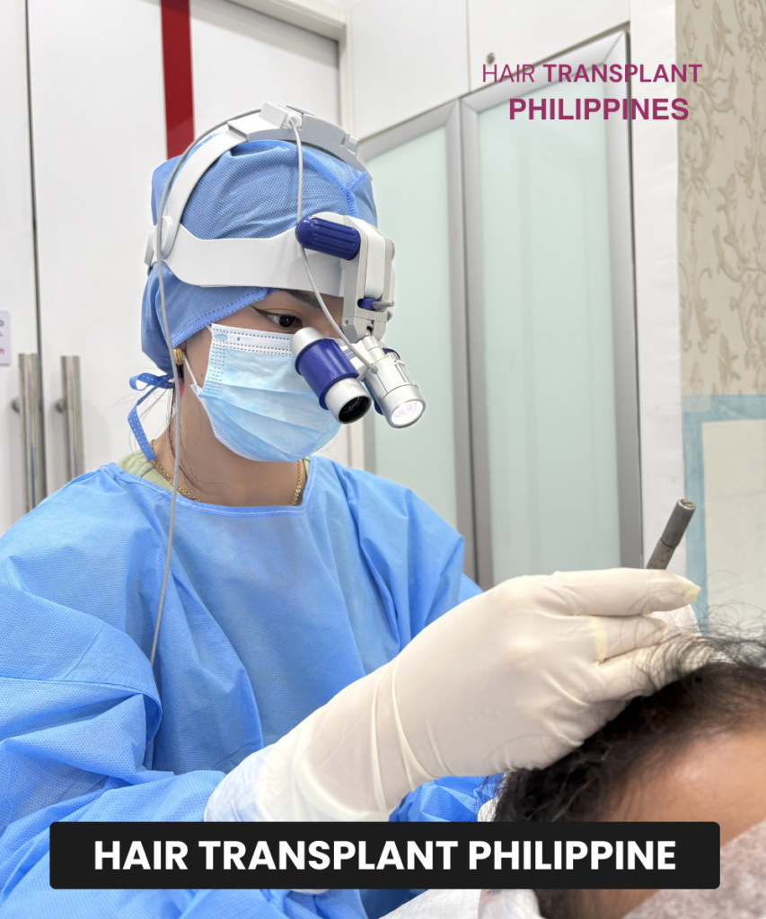 HAIR TRANSPLANT CENTRE PHILIPPINES gallery photo