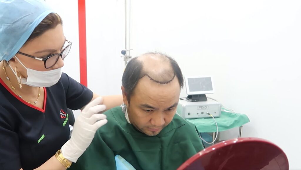 HAIR TRANSPLANT CENTRE PHILIPPINES gallery photo