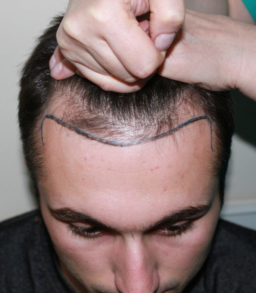 Transplant de păr – Hair transplant Bucuresti — clinic photo from Google Maps