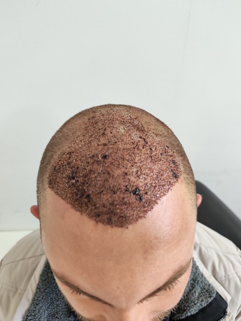 Erna Hair Clinic İzmir Saç Ekim Merkezi gallery photo