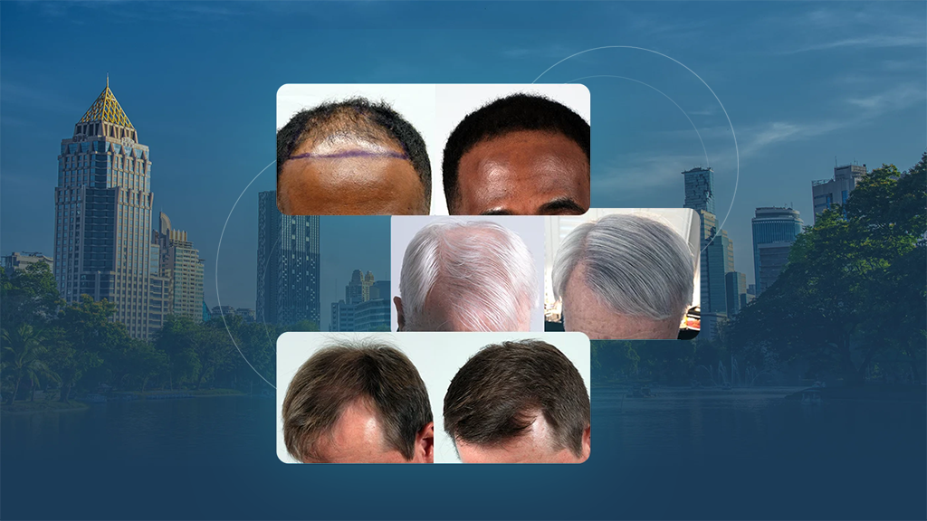 Lee Hair Restoration gallery photo