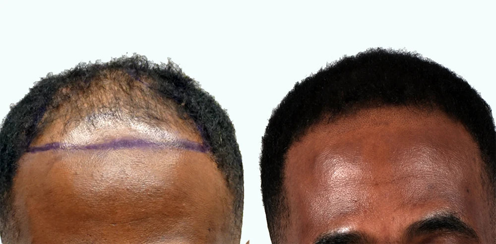 Lee Hair Restoration gallery photo