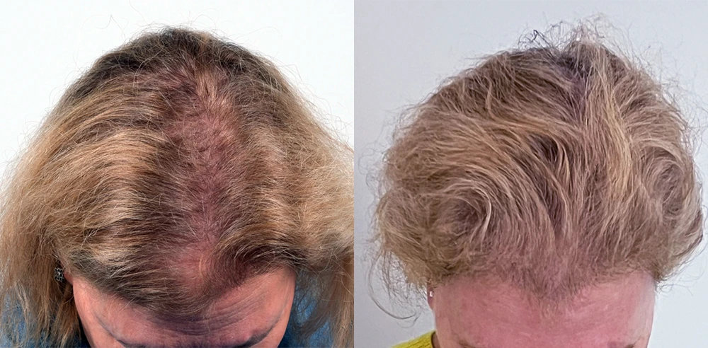 Lee Hair Restoration gallery photo