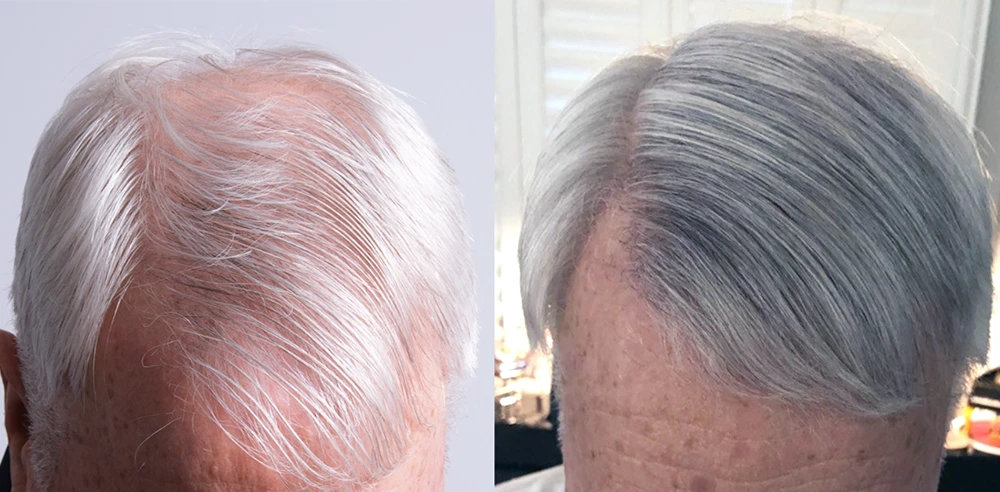 Lee Hair Restoration gallery photo