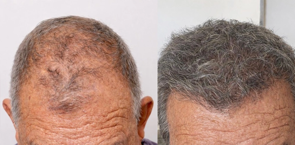 Lee Hair Restoration gallery photo
