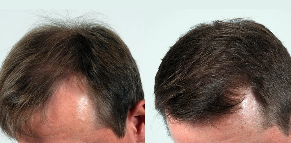 Lee Hair Restoration gallery photo