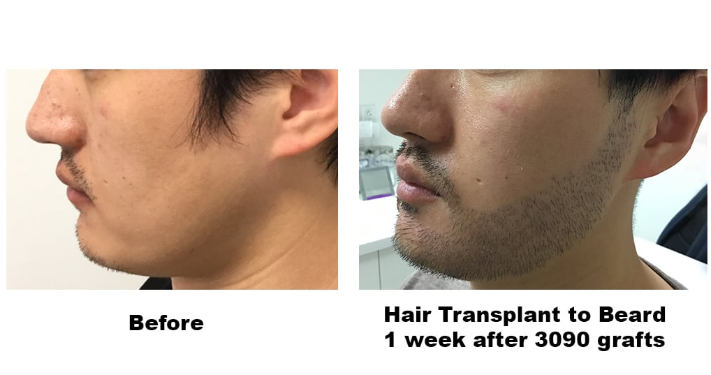 Hair Restoration Center gallery photo